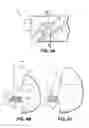Fig. 06 - Contour rake face cutting tool