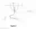 Fig. 03 - Cable guide attachment structure