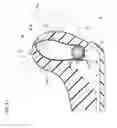 Fig. 20 - Side airbag system