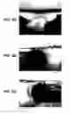 Fig. 07 - Surf wake system for a watercraft