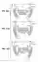 Fig. 17 - Surf wake system for a watercraft