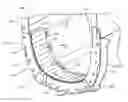 Fig. 01 - Segmented shape-compliant wear pad for telescoping boom assembly