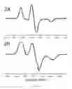 Fig. 03 - Site-specific dynamic nuclear polarization NMR agents