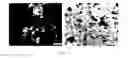 Fig. 04 - Crystal forms of ()-4-(8-amino-3-(1-(but-2-ynoyl)pyrrolidin-2-yl)imidazo[1,5-]pyrazin-1-yl)--(pyridin-2-yl)benzamide