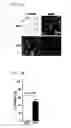 Fig. 14 - Compositions and Methods for Treating Neoplasia, Inflammatory Disease and Other Disorders