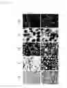 Fig. 16 - Compositions and Methods for Treating Neoplasia, Inflammatory Disease and Other Disorders