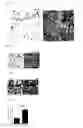 Fig. 17 - Compositions and Methods for Treating Neoplasia, Inflammatory Disease and Other Disorders