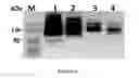 Fig. 07 - MSP nanopores and uses thereof
