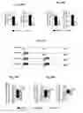 Fig. 16 - Reducing systemic regulatory T cell levels or activity for treatment of disease and injury of the CNS