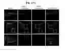 Fig. 20 - Reducing systemic regulatory T cell levels or activity for treatment of disease and injury of the CNS