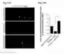 Fig. 30 - Reducing systemic regulatory T cell levels or activity for treatment of disease and injury of the CNS