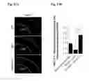 Fig. 31 - Reducing systemic regulatory T cell levels or activity for treatment of disease and injury of the CNS