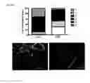 Fig. 13 - Stimulation via TLR4/MD-2 to reverse type 1 diabetes