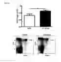 Fig. 14 - Stimulation via TLR4/MD-2 to reverse type 1 diabetes