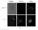 Fig. 16 - Methods for reprogramming cells and uses thereof