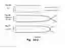 Fig. 04 - Biomarkers for diagnosing ischemia