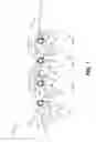 Fig. 02 - Electroless plating system including bubble guide