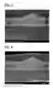Fig. 04 - Copper Electrodeposition in Microelectronics