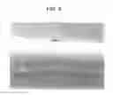 Fig. 03 - HIGH STRENGTH FABRICS CONSISITING OF THIN GAUGE CONSTANT COMPRESSION ELASTIC FIBERS