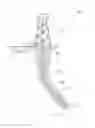 Fig. 01 - Downhole drill bit cutting element with chamfered ridge