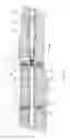 Fig. 29 - Top-down fracturing system