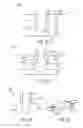 Fig. 04 - Well treatment design based on three-dimensional wellbore shape