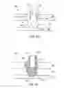 Fig. 05 - Well treatment design based on three-dimensional wellbore shape