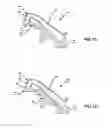 Fig. 03 - FLUID-TRANSFER DEVICE AND METHOD FOR MANUFACTURING SAME