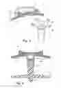 Fig. 03 - Fastener assembly for insulation blanket