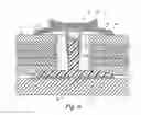 Fig. 05 - Fastener assembly for insulation blanket
