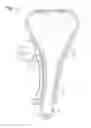 Fig. 02 - Tensioner
