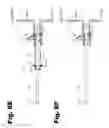 Fig. 11 - Valve replacement device