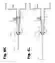 Fig. 14 - Valve replacement device