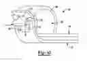 Fig. 07 - CAPTIVATING CLAMP