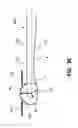Fig. 09 - Limb support apparatus and method