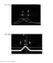 Fig. 09 - Microparticle measuring apparatus