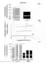Fig. 04 - DIAGNOSIS OF CHRONIC KIDNEY DISEASE BY QUANTITATIVE ANALYSIS OF POST-TRANSLATIONAL MODIFICATIONS OF PLASMA PROTEINS