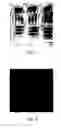 Fig. 04 - Compact Side and Multi Angle Illumination Lensless Imager and Method of Operating the Same
