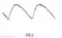 Fig. 07 - Light Flicker Canceling Glasses