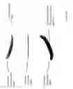 Fig. 11 - Thermal management for head-worn computer