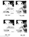 Fig. 26 - Methods and apparatus concerning sensitive force sensors