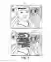 Fig. 04 - Area-dependent image enhancement