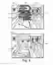 Fig. 05 - Area-dependent image enhancement