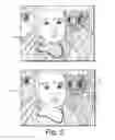Fig. 06 - Area-dependent image enhancement