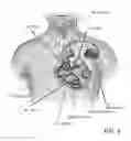 Fig. 03 - SYSTEM AND METHOD FOR BIOMEDICAL SIMULATION