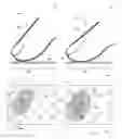 Fig. 01 - Acquisition of a fingerprint image