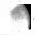 Fig. 08 - Sweat Pores Imaging Method and Device