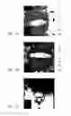 Fig. 03 - Systems and methods for automated voxelation of regions of interest for magnetic resonance spectroscopy