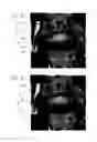 Fig. 04 - Systems and methods for automated voxelation of regions of interest for magnetic resonance spectroscopy