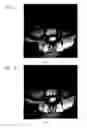 Fig. 06 - Systems and methods for automated voxelation of regions of interest for magnetic resonance spectroscopy